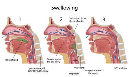 Difficulty Swallow 111