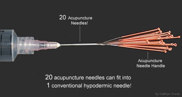 ANTRAC Acupuncture Clinic, Toowoomba